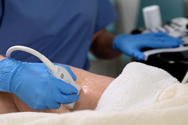 Échographie du bras avec le GE LOGIQ S8 – Diagnostic précis en radiologie et imagerie médicale.