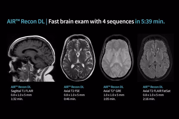 Des examens cérébraux plus rapides avec une meilleure résolution. Un examen rapide du cerveau comprenant 4 séquences en 5 min 39 s.