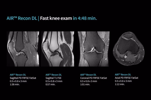 Examen rapide du genou en 4:48 min