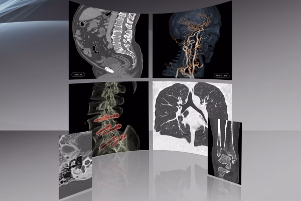 Scanner résolution spatiale