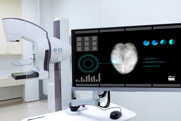 Mammographe GE Senographe Crystal affichant une image de dépistage du cancer du sein.